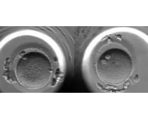 济南代孕去哪家最好,做了试管婴儿的患者饮食要更加用心，试管婴儿移植后饮