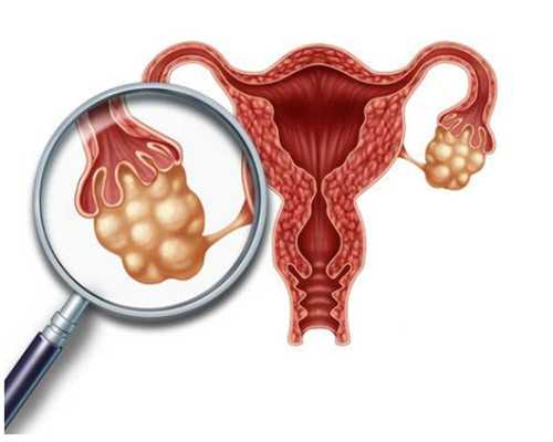 试管贵州助孕中胎停育的原因