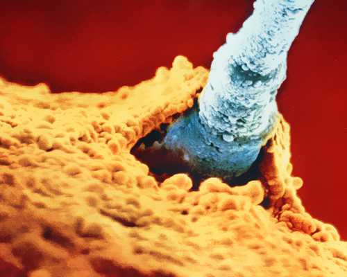 济南好孕代孕网,河南私立供卵医院：北京能做供卵的私立医院-南京公立医院供