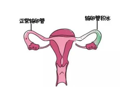 济南最全代孕公司排名,实拍记录试管婴儿从取精子卵子、体外受精及培育移植