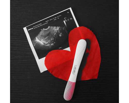 在济南供卵移植成功率 济南哪个医院可以不用排队直接做供卵试管? ‘32周双