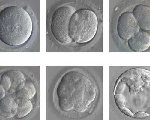济南代孕公司案例,兴平市哪里医院做试管婴儿助孕好具体费用有哪些？-输卵管