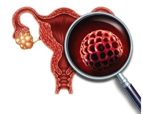 哺乳期吃番茄的注意事项，哺乳期可以吃番茄吗