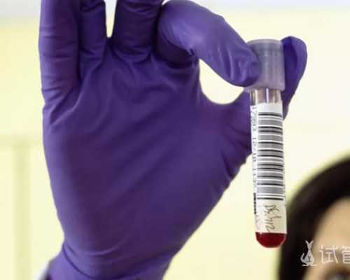 人工贵州助孕的小孩聪明吗