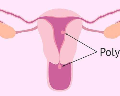 济南代孕医院推荐,山东人类精子库报名,济南精子库需要多少钱