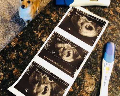 济南寻找供卵试管公司 济南铁路医院试管怎么样？能解决问题吗？ ‘怀孕四维