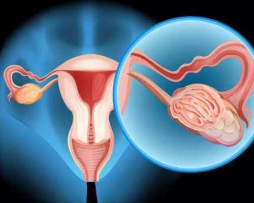 济南女性不孕的原因：济南女性不孕不育症检查-代生孩子费用