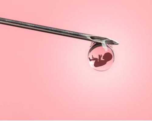 高龄女性贵州助孕策略