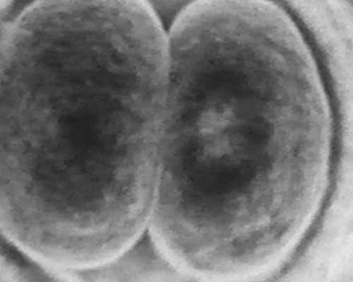 济南试管供卵套餐 济南试管婴儿医院排名有哪些?哪家医院比较不错? ‘32周