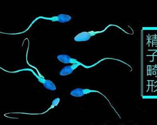 济南供卵移植的年龄 济南有没有不用排队等待就能做供卵试管的医院? ‘十三