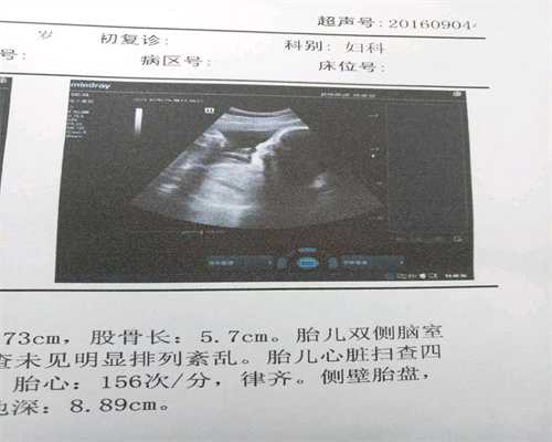 贵州代孕要做体检视频_2月代孕预产期是几月