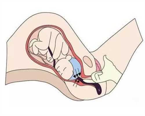 IVF：腺嘌呤可以怀孕一个孩子
