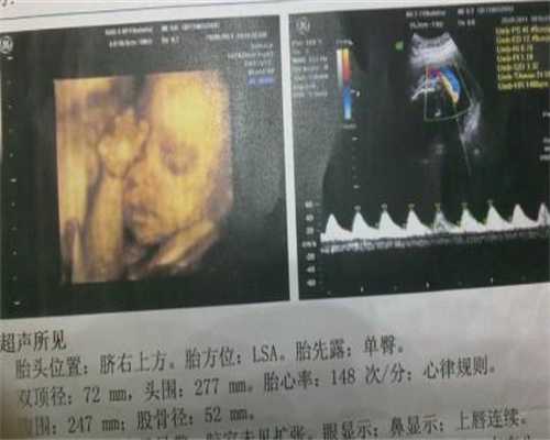 贵州找靠谱代孕-找个代妈代孕多少钱_染色体异常不孕，做第三代试管婴儿成功怀孕！