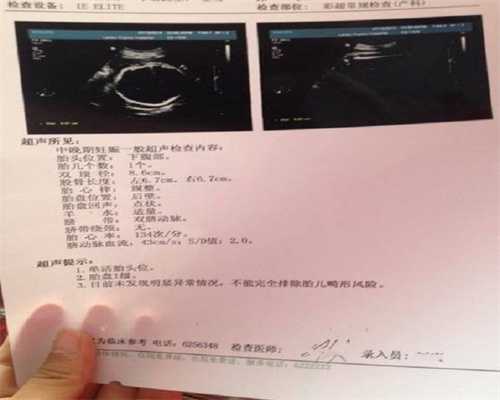 找个女的代孕的多少钱-贵州代孕妈妈_武汉大学人民医院生殖中心李爱斌做试管成功率怎样？