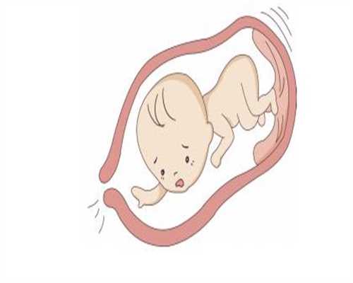 贵州代孕成功率有多少-代孕可以选择性别_輸卵管阻塞的症狀有什么_深圳怡康婦