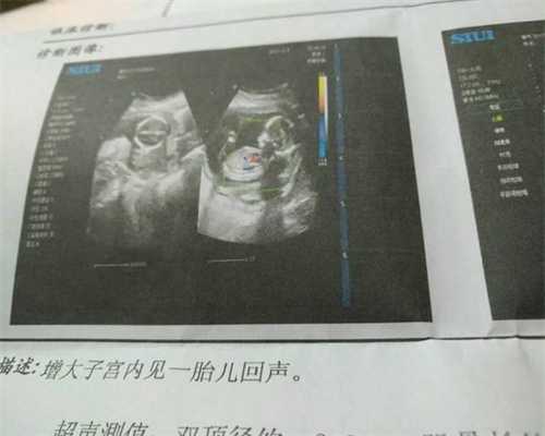 助孕公司名称-贵州代孕生儿子多少钱_女性应该如何预防急性附件炎的发生？